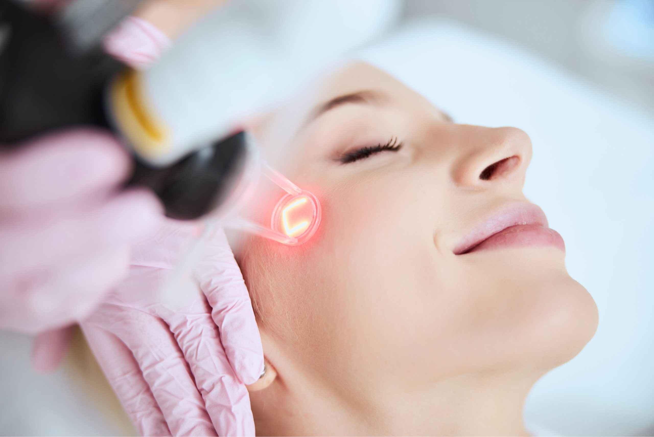 Achieve Glowing Skin with Advanced Pico Laser